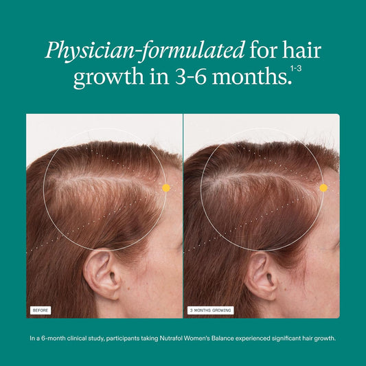 Nutrafol Women’s Balance Hair Growth Supplement – 120 Capsules | Ages 45+ | 1-Month Supply